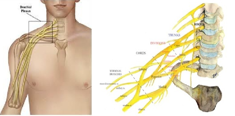 Brachial Plexus Surgery